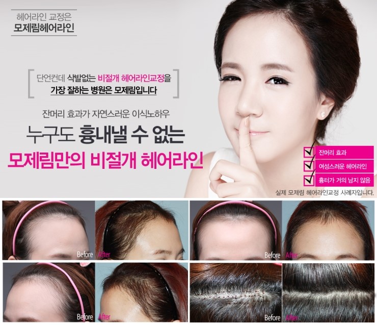 라인헤어 이미지