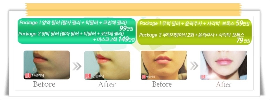 완전좋아 이미지