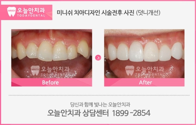 오늘의치과 이미지