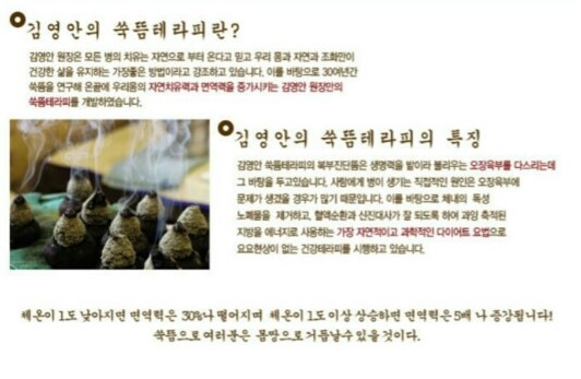 왕쑥뜸테라피 이미지