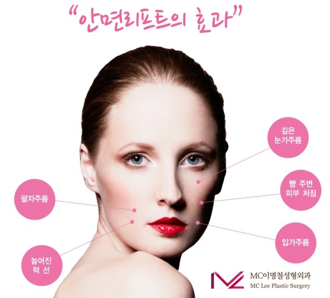 이명철성형외과 이미지