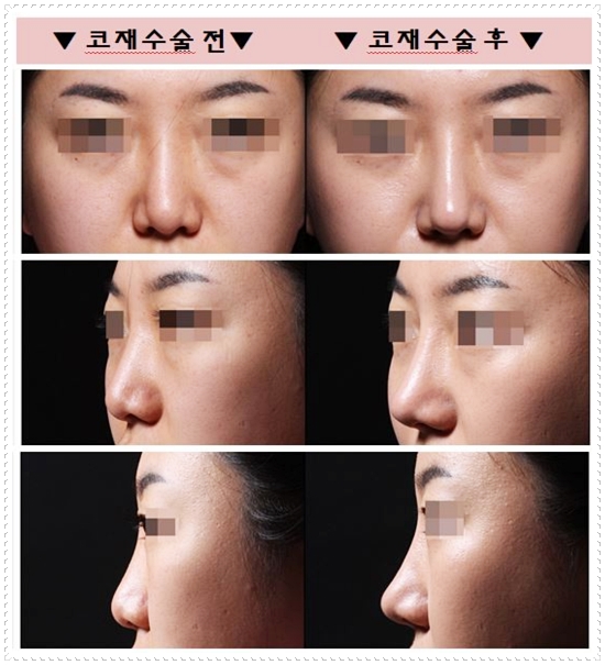 모든출력 이미지