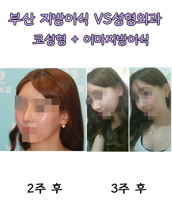 글로벌통신 이미지