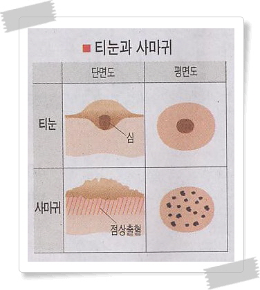 티문 이미지