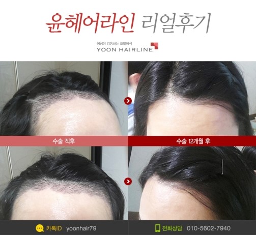 윤헤어 이미지