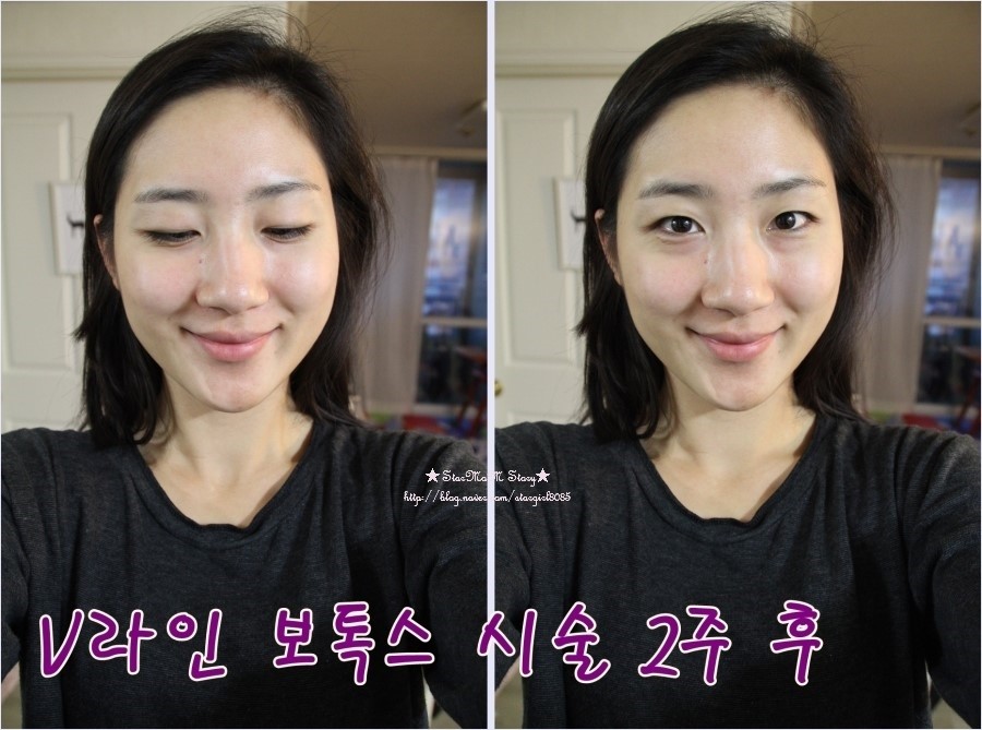 덕소엔비의원 이미지