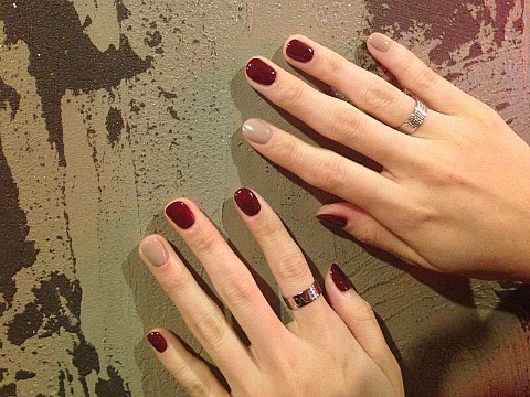 아이네일(I-NAIL) 이미지