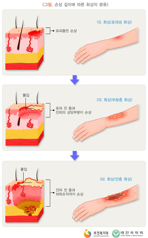 심재성 이미지