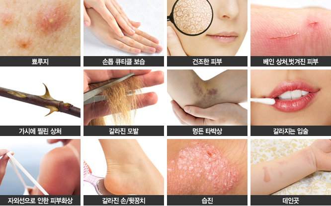 파파포포 이미지