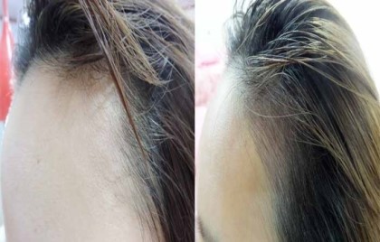 이미지헤어라인 이미지