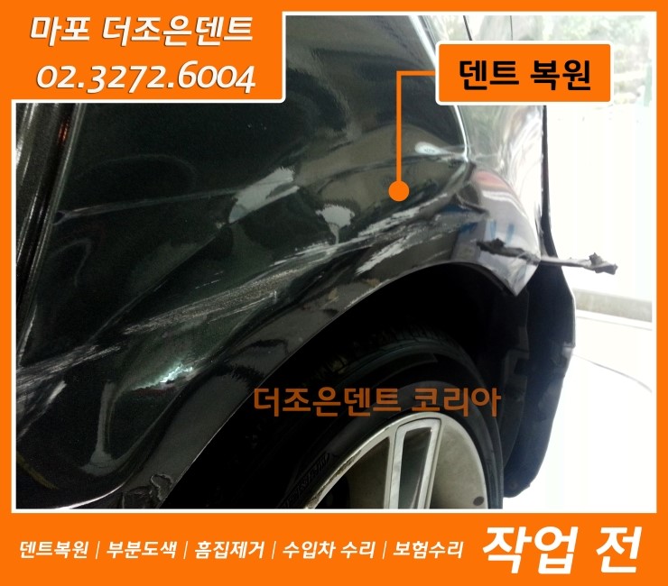 더조은덴트 이미지