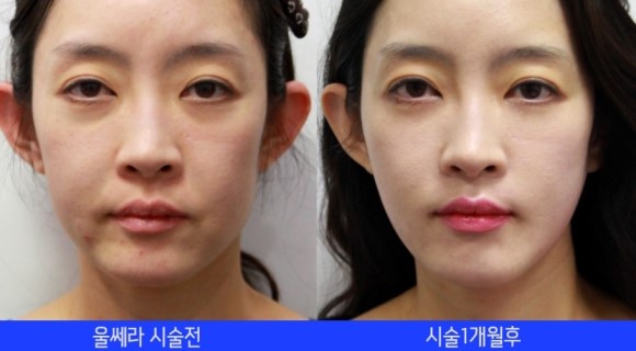 와이와이와이 이미지