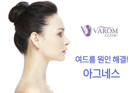 아그네스 이미지