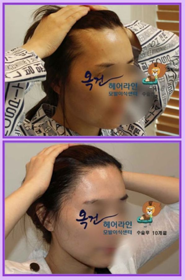 미끼헤어 이미지