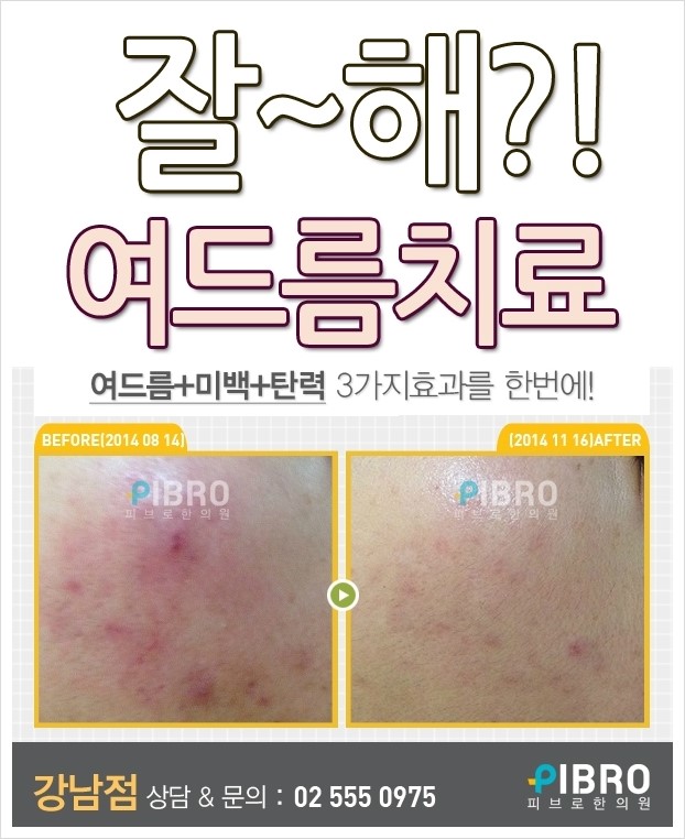 차케 이미지
