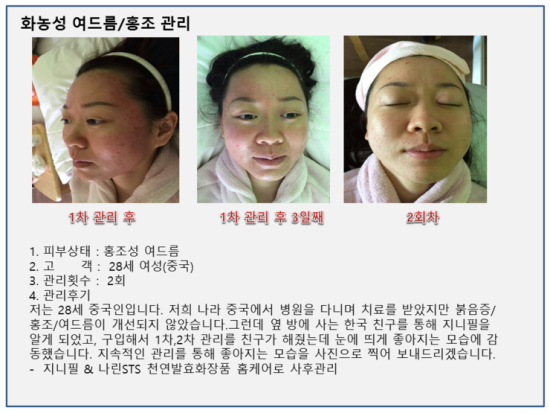 지니홈케어 이미지