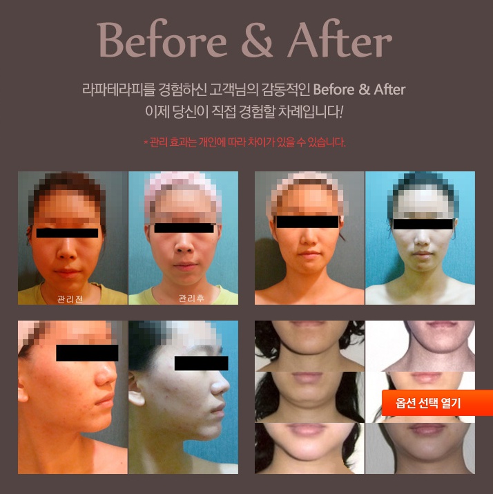 샤인피부관리실 이미지