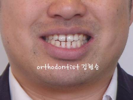 미소가아름다운치과 이미지