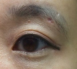 코코블라썸 이미지