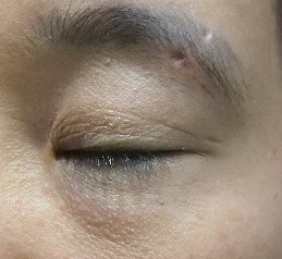 코코블라썸 이미지