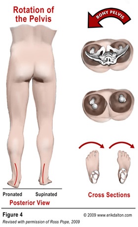 머슬테라피 이미지