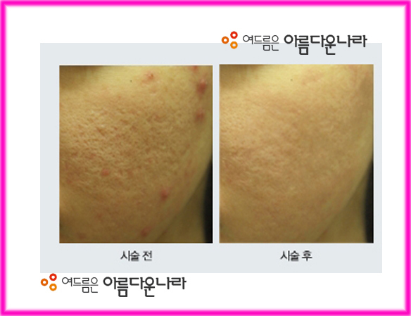 아름다운나라피부과 이미지