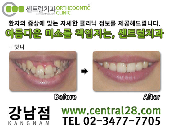 강북센트럴치과 이미지