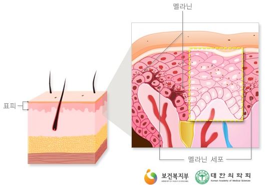 천안수피부과 이미지