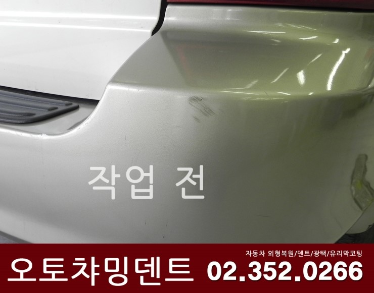 오토덴트칼라 이미지