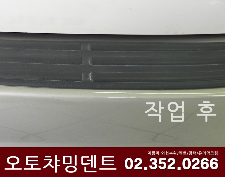 오토덴트칼라 이미지