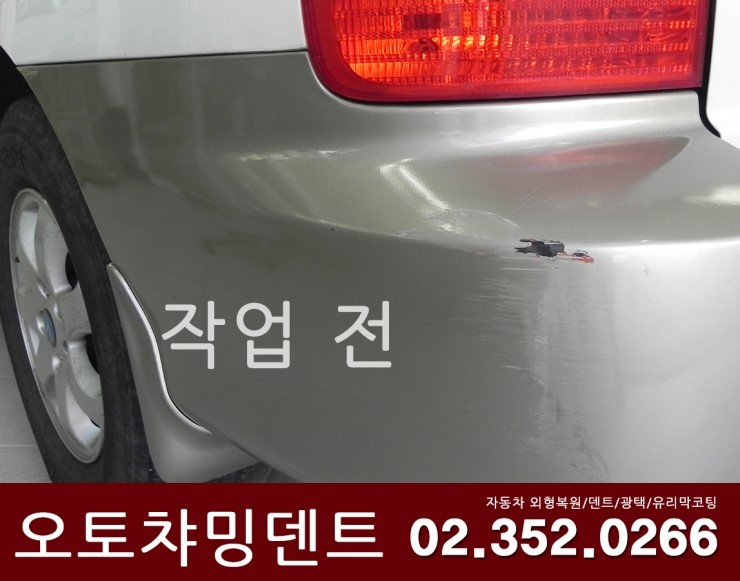 오토덴트칼라 이미지