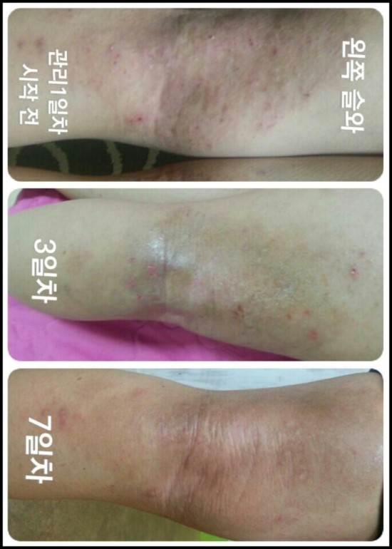 라인스킨 이미지