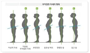바른걸음-바른자세 이미지