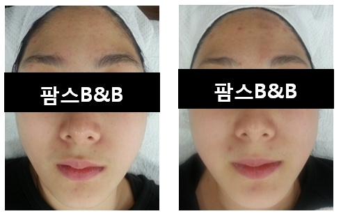 퀸즈에스테틱 이미지