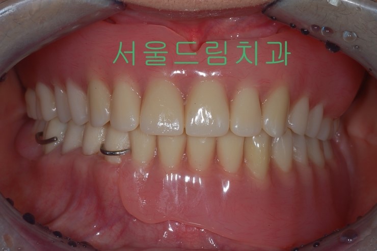 나무하나치과 이미지