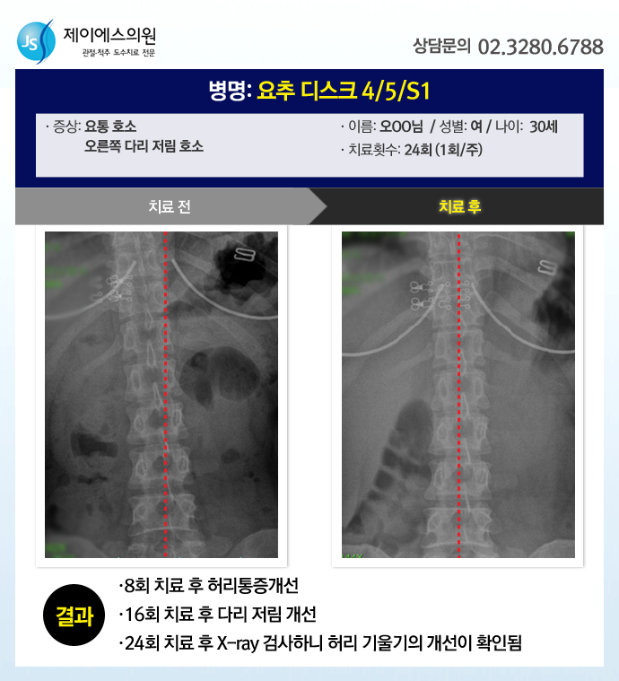 제이에스의원 이미지
