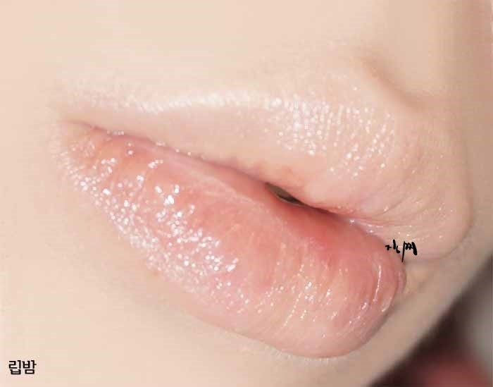 림팩트 이미지