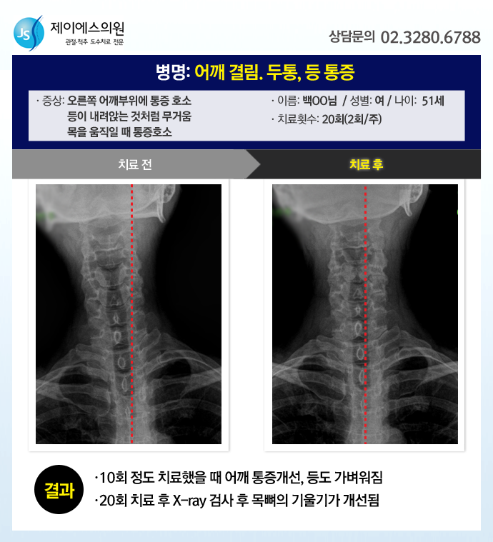 제이에스의원 이미지