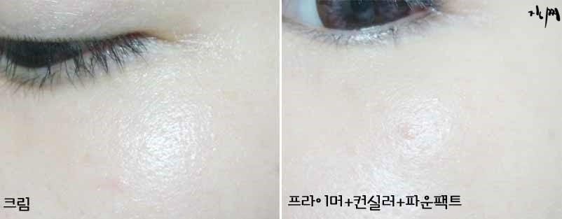 림팩트 이미지