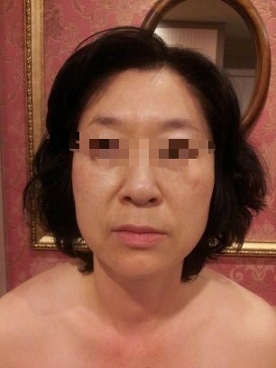 비비테라피 이미지