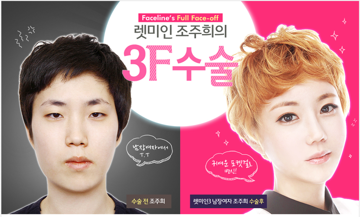 페이스라인(FACELINE) 이미지