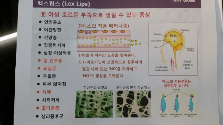 달렉스 이미지