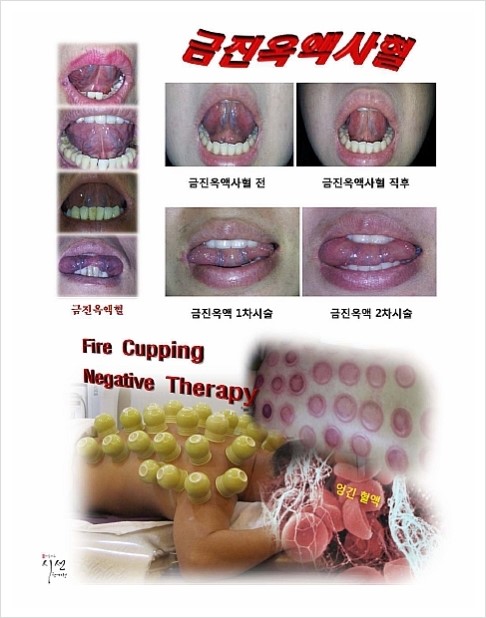 순환한의원 이미지