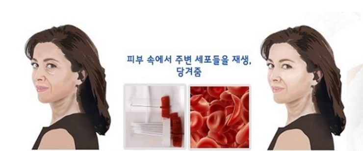 스타케이의원 이미지