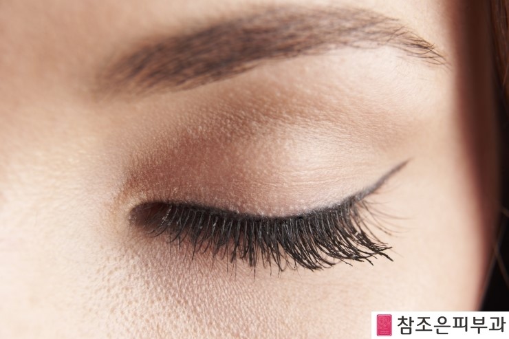 참조은피부과 이미지