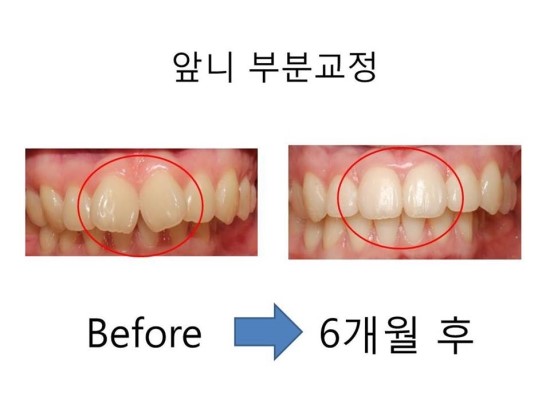 바로이치과 이미지