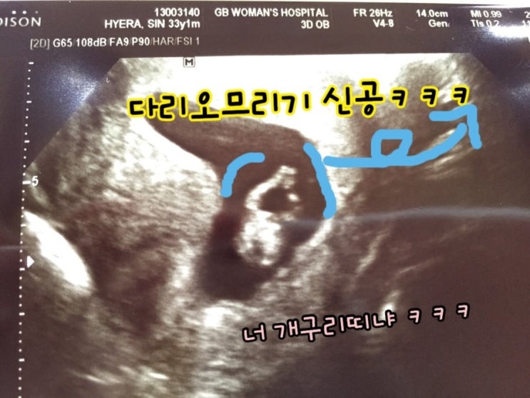 후르쯔 이미지