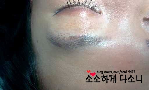 핑크핑거(pink finger) 이미지