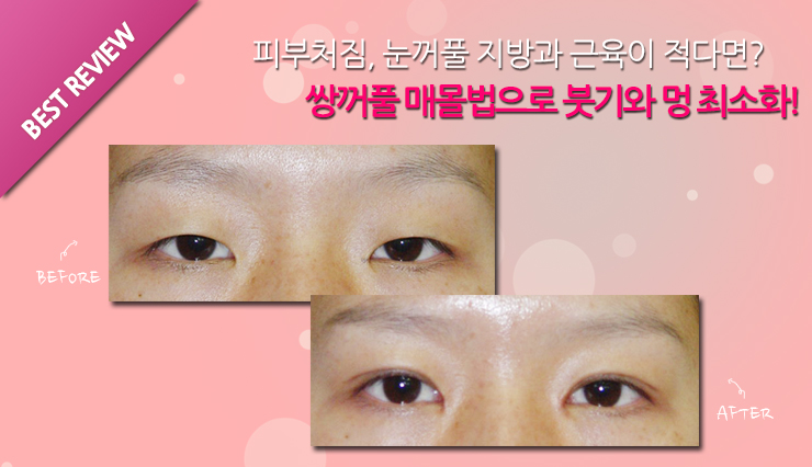 이재경성형외과 이미지