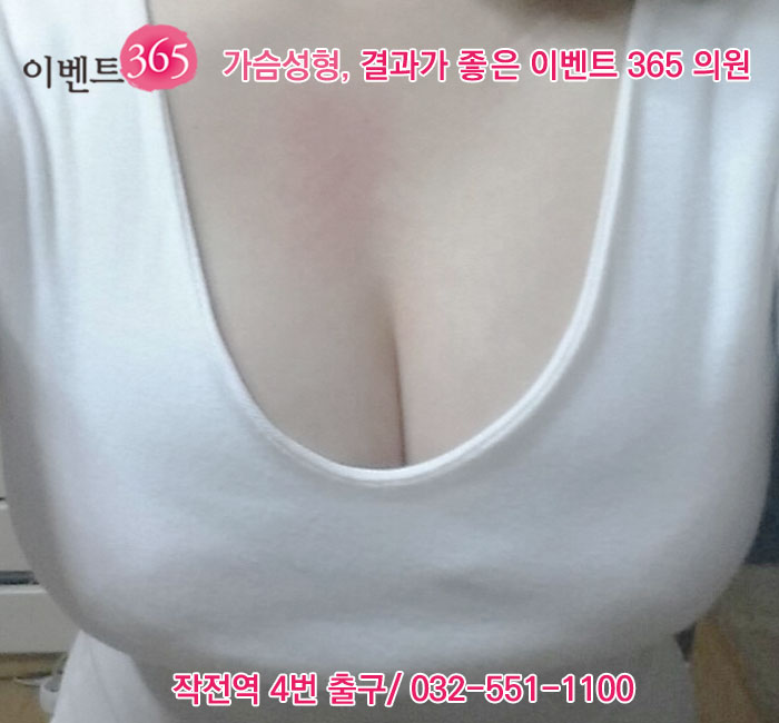 볼륨성형외과의원 이미지